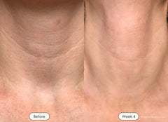 VitaGlow Pro™ - 7-Color LED Therapy Mask for Face & Neck