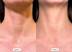 VitaGlow Pro™ - 7-Color LED Therapy Mask for Face & Neck