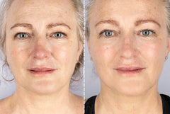 VitaGlow Pro™ - 7-Color LED Therapy Mask for Face & Neck